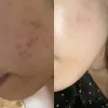 تونر لایه بردار و روشن کننده گلیکولیک اسید 7% اوردینری
