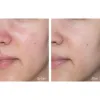 ژل کرم آبرسان و تسکین دهنده سرامید ایلیون