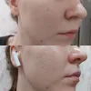 سرم روشن کننده و کنترل منافذ تیام