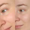 ماسک خواب ترمیم کننده و جوانساز حلزون و آزولن تیام