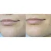 کرم مرطوب کننده پوست خشک و خیلی خشک سراوی