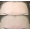 کرم مرطوب کننده پوست خشک و خیلی خشک سراوی