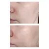 کرم مرطوب کننده پوست خشک و خیلی خشک سراوی