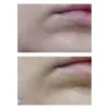 کرم مرطوب کننده پوست خشک و خیلی خشک سراوی