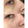کرم مرطوب کننده پوست خشک و خیلی خشک سراوی