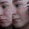 ژل شستشوی سالیسیلیک اسید سراوی