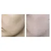 ژل شستشوی سالیسیلیک اسید سراوی
