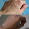 ژل شستشوی سالیسیلیک اسید سراوی
