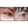 سرم اوردینری آرژیرلین ۱۰% ضدچروک و پر کننده خطوط صورت و دور چشم