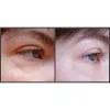 سرم اوردینری آرژیرلین ۱۰% ضدچروک و پر کننده خطوط صورت و دور چشم