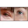 سرم اوردینری آرژیرلین ۱۰% ضدچروک و پر کننده خطوط صورت و دور چشم