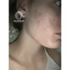 اسنس تقویت کننده و تسکین دهنده ریدل شات 100 وی تی کازمتیک