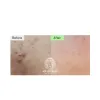 اسنس تقویت کننده و تسکین دهنده ریدل شات 100 وی تی کازمتیک