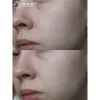 کرم مرطوب کننده روزانه بتاگلوکان آیونیک