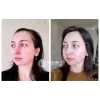 کرم مرطوب کننده پرو بالانس بیوتیک دکتر سراکل