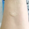 ژل لایه بردار و صاف کننده پوست صورت نیتروژنا نوتروژینا