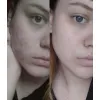 ژل شستشوی پوست چرب و مختلط بایودرما