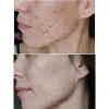 ژل شستشوی پوست چرب و مختلط بایودرما