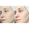 ژل شستشوی پوست چرب و مختلط بایودرما