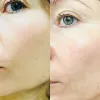 فوم ژل شستشوی صورت سنسیبیو بایودرما مخصوص پوست حساس و خشک
