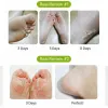 ماسک لایه بردار و نرم کننده پا پیوردرم