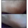 ماسک لایه بردار و نرم کننده پا پیوردرم
