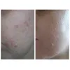 کرم ضد جوش افکلار کا پلاس لاروش پوزای