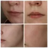 کرم ترمیم کننده سیکالیفت پلاست اون