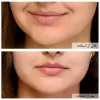 ژل شستشوی نورمادرم ویشی مخصوص پوست چرب و جوش دار