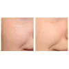ژل شستشوی نورمادرم ویشی مخصوص پوست چرب و جوش دار
