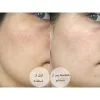 ژل شستشوی نورمادرم ویشی مخصوص پوست چرب و جوش دار