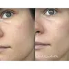 ژل شستشوی نورمادرم ویشی مخصوص پوست چرب و جوش دار