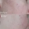 فوم شوینده پوست آتشفشانی ججو اینیسفری
