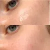 سرم ضد لک و روشن کننده 30 روزه یوجا نیاسین سام بای می