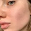 سرم ضد لک و روشن کننده 30 روزه یوجا نیاسین سام بای می