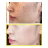 سرم ضد لک و روشن کننده 30 روزه یوجا نیاسین سام بای می