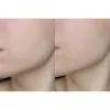 سرم ویتامین سی گالاکتومایسس سام بای می