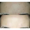 سرم آبرسان موسین حلزون و هیالورونیک اسید کاز دی باها