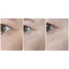 سرم ضد چروک و روشن کننده دور چشم رولی سرامید فارم استی