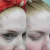 سرم روغنی رتینول 0.5 درصد کوزارکس ضد چین و چروک و آکنه