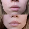 کرم ترمیم کننده سیکاپلاست لاروش پوزای