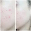 کرم ترمیم کننده سیکاپلاست لاروش پوزای