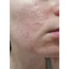 کرم ترمیم کننده سیکاپلاست لاروش پوزای