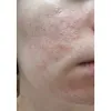 کرم ترمیم کننده سیکاپلاست لاروش پوزای