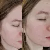تونر کوچک کننده منافذ سوپر ماچا سام بای می