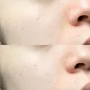سرم کوچک کننده منافذ سوپر ماچا سام بای می