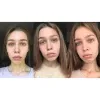 تونر  ضد جوش و آبرسان 30 روزه میراکل سام بای می