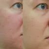 سرم پیلینگ و لایه بردار قوی زامبی بلادی اسکین