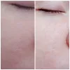 تونر تسکین دهنده و تقویت کننده موچی سرامید تونی مولی