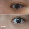 کرم دور چشم ترانگزامیک اسید و رتینال دکتر ملاکسین ضد چروک و روشن کننده قوی